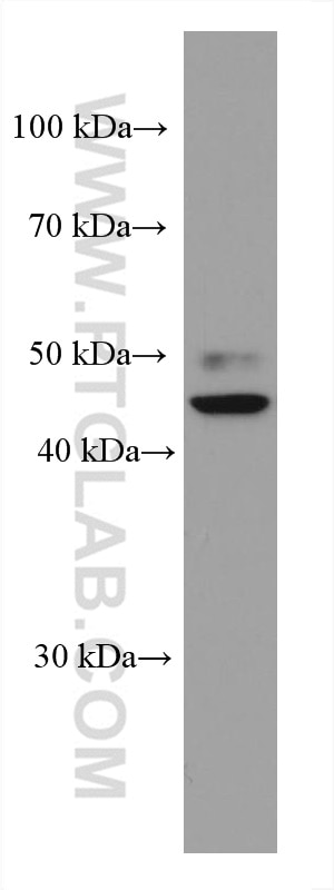 Western Blot (WB) analysis of Jurkat cells using TERF1 Monoclonal antibody (67592-1-Ig)