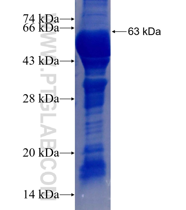 TERF1 fusion protein Ag2491 SDS-PAGE