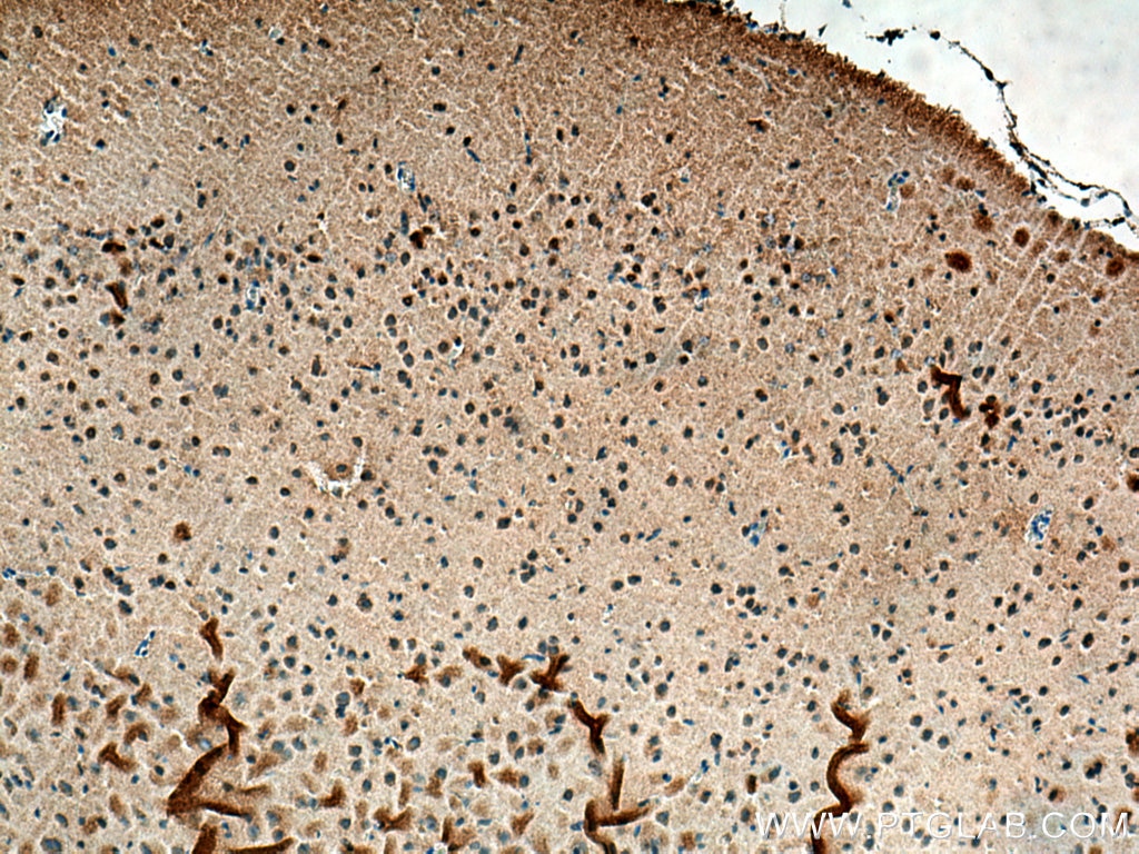 Immunohistochemistry (IHC) staining of rat brain tissue using TERF2 Polyclonal antibody (22020-1-AP)