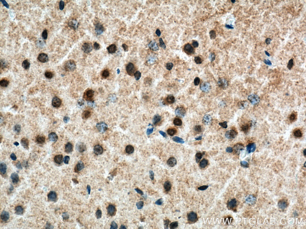 IHC staining of rat brain using 22020-1-AP