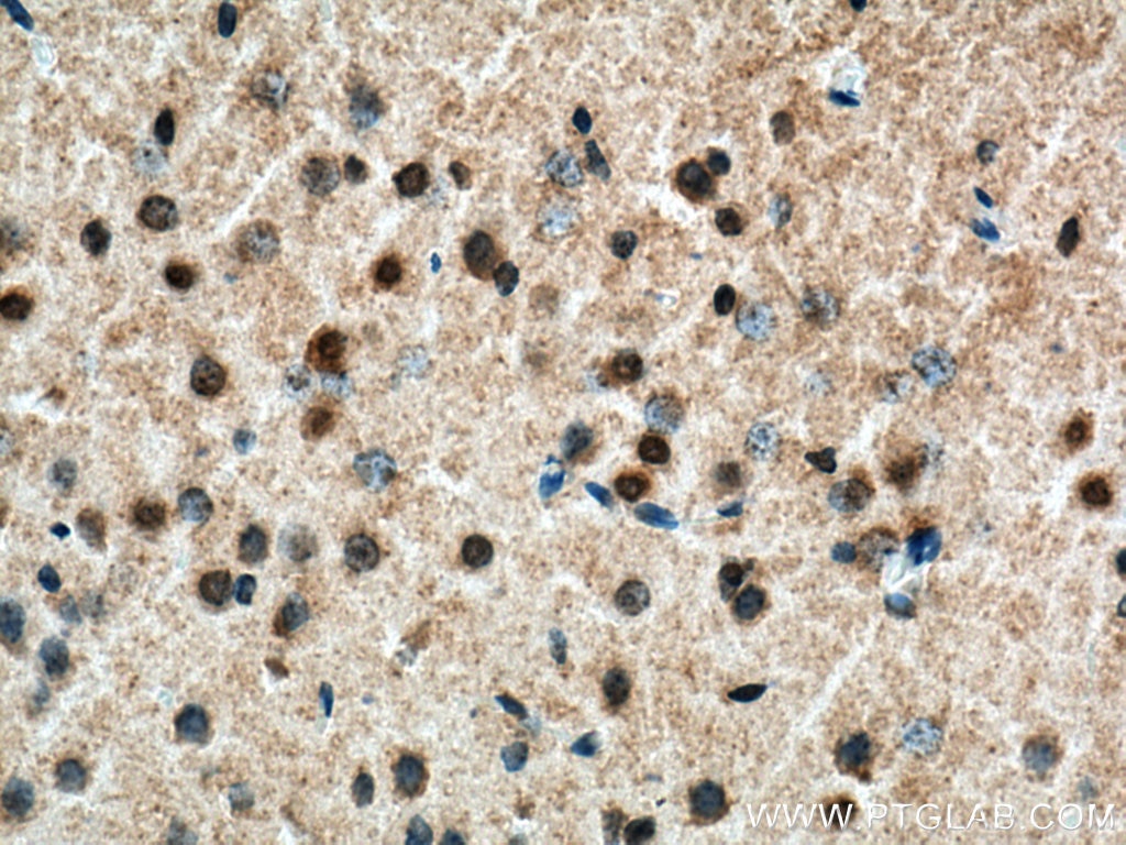 Immunohistochemistry (IHC) staining of rat brain tissue using TERF2 Polyclonal antibody (22020-1-AP)