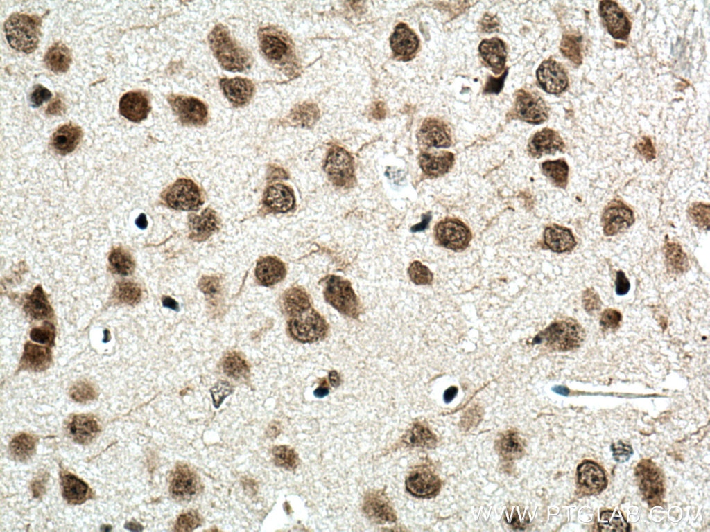 Immunohistochemistry (IHC) staining of mouse brain tissue using TERF2 Polyclonal antibody (22020-1-AP)