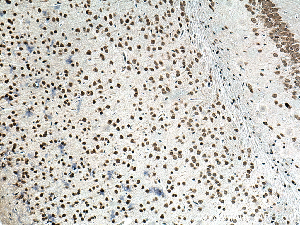 Immunohistochemistry (IHC) staining of mouse brain tissue using TERF2 Polyclonal antibody (22020-1-AP)