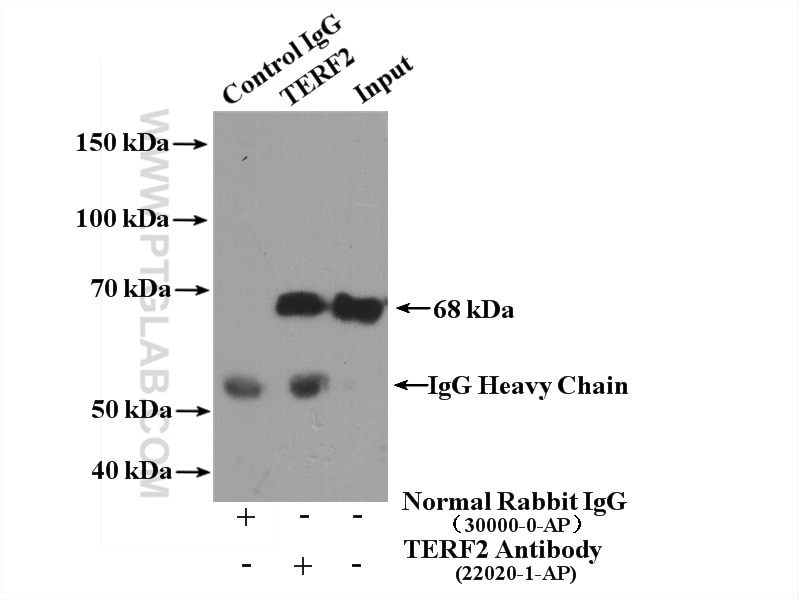 Immunoprecipitation (IP) experiment of K-562 cells using TERF2 Polyclonal antibody (22020-1-AP)