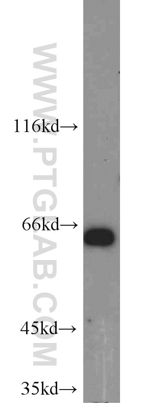 Western Blot (WB) analysis of HeLa cells using TERF2 Polyclonal antibody (22020-1-AP)