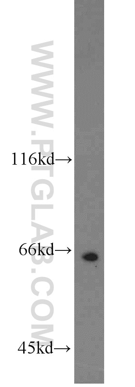 Western Blot (WB) analysis of MCF-7 cells using TERF2 Polyclonal antibody (22020-1-AP)