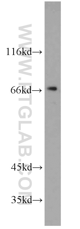 Western Blot (WB) analysis of NIH/3T3 cells using TERF2 Polyclonal antibody (22020-1-AP)