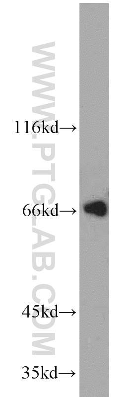 Western Blot (WB) analysis of Jurkat cells using TERF2 Polyclonal antibody (22020-1-AP)