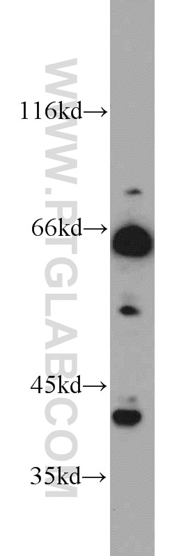 Western Blot (WB) analysis of K-562 cells using TERF2 Polyclonal antibody (22020-1-AP)