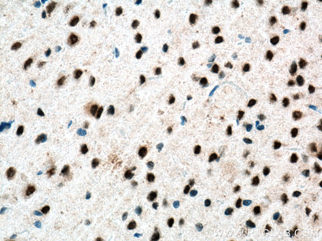 Immunohistochemistry (IHC) staining of rat brain tissue using TERF2 Monoclonal antibody (66893-1-Ig)