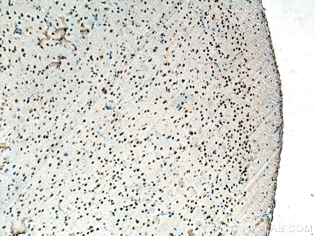 Immunohistochemistry (IHC) staining of rat brain tissue using TERF2 Monoclonal antibody (66893-1-Ig)