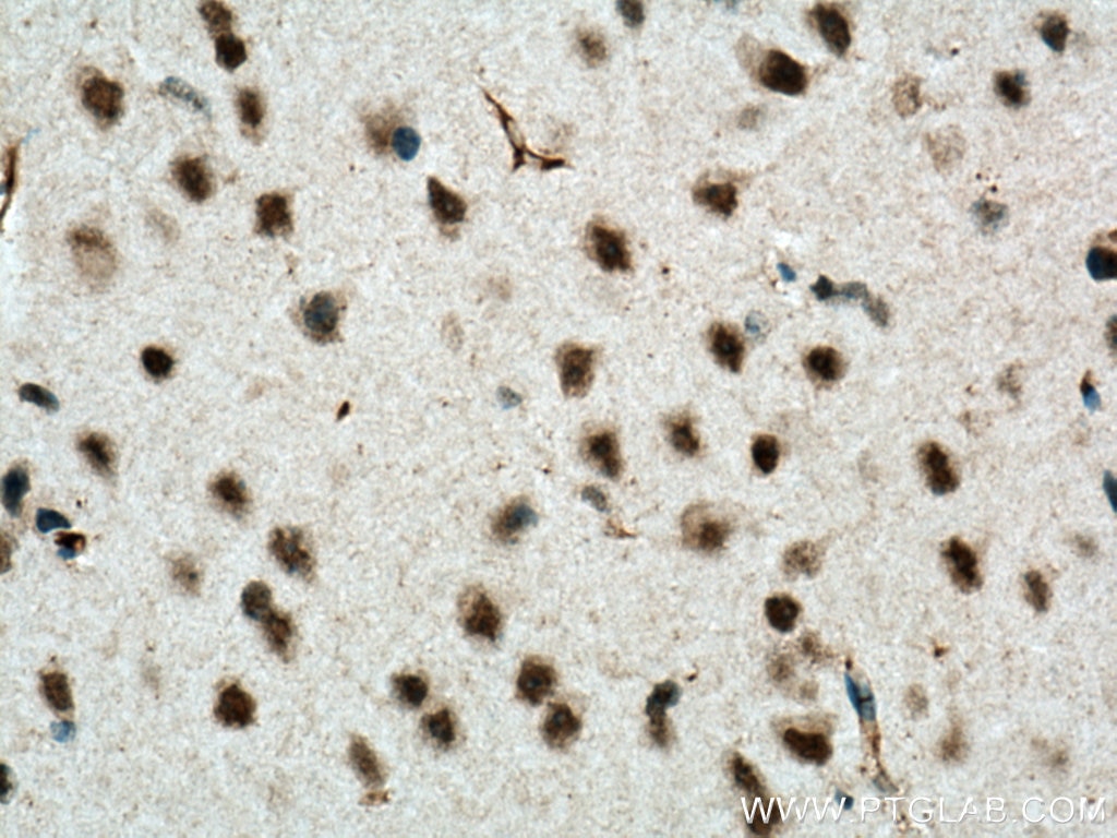 IHC staining of mouse brain using 66893-1-Ig