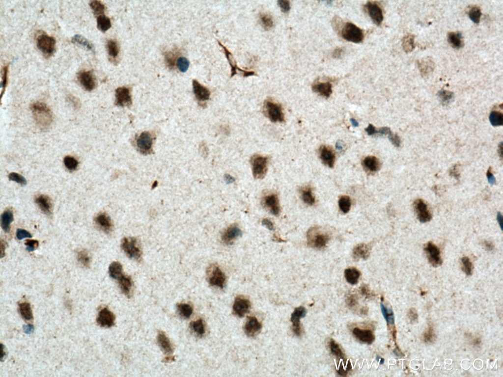 Immunohistochemistry (IHC) staining of mouse brain tissue using TERF2 Monoclonal antibody (66893-1-Ig)