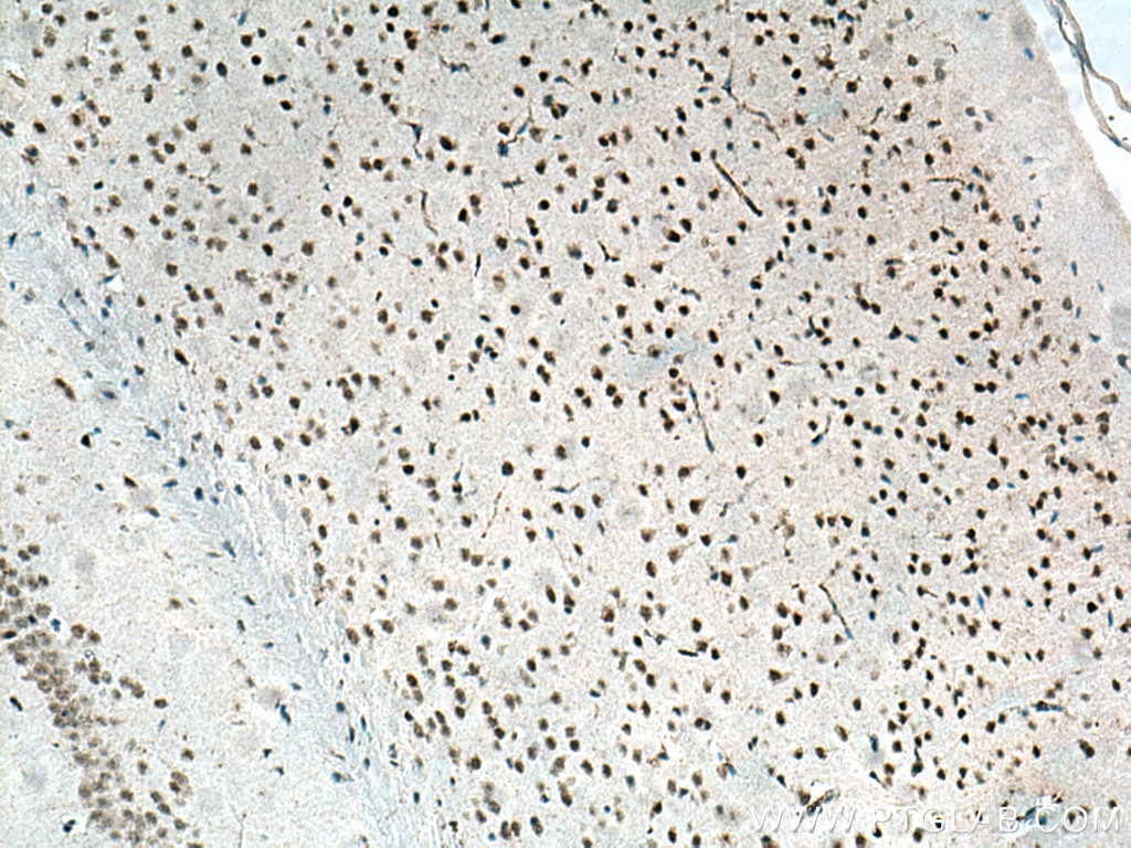 Immunohistochemistry (IHC) staining of mouse brain tissue using TERF2 Monoclonal antibody (66893-1-Ig)