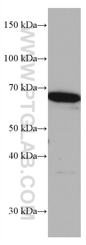 Western Blot (WB) analysis of MCF-7 cells using TERF2 Monoclonal antibody (66893-1-Ig)