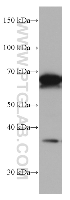 Western Blot (WB) analysis of Jurkat cells using TERF2 Monoclonal antibody (66893-1-Ig)