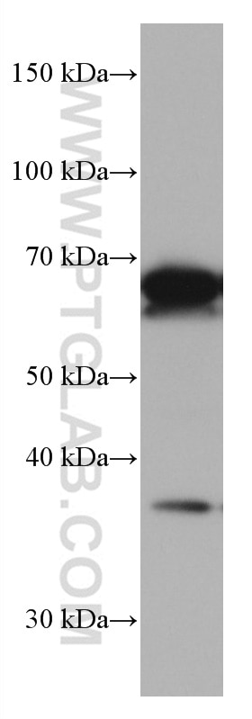 WB analysis of Jurkat using 66893-1-Ig