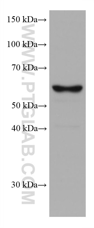 Western Blot (WB) analysis of Jurkat cells using TERF2 Monoclonal antibody (66893-1-Ig)