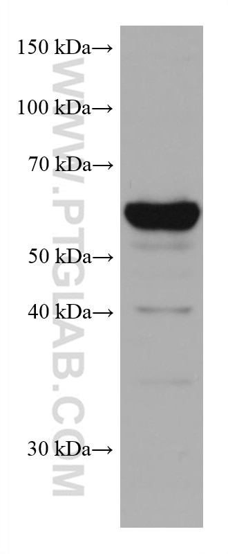 Western Blot (WB) analysis of Daudi cells using TERF2 Monoclonal antibody (66893-1-Ig)