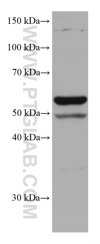 Western Blot (WB) analysis of HSC-T6 cells using TERF2 Monoclonal antibody (66893-1-Ig)