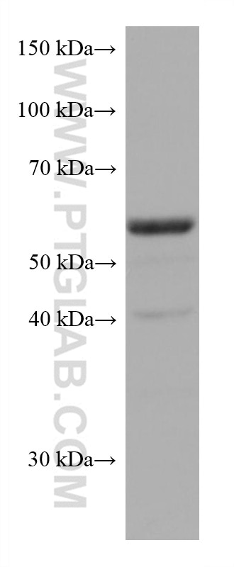 Western Blot (WB) analysis of 4T1 cells using TERF2 Monoclonal antibody (66893-1-Ig)