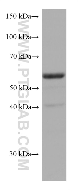 WB analysis of 4T1 using 66893-1-Ig