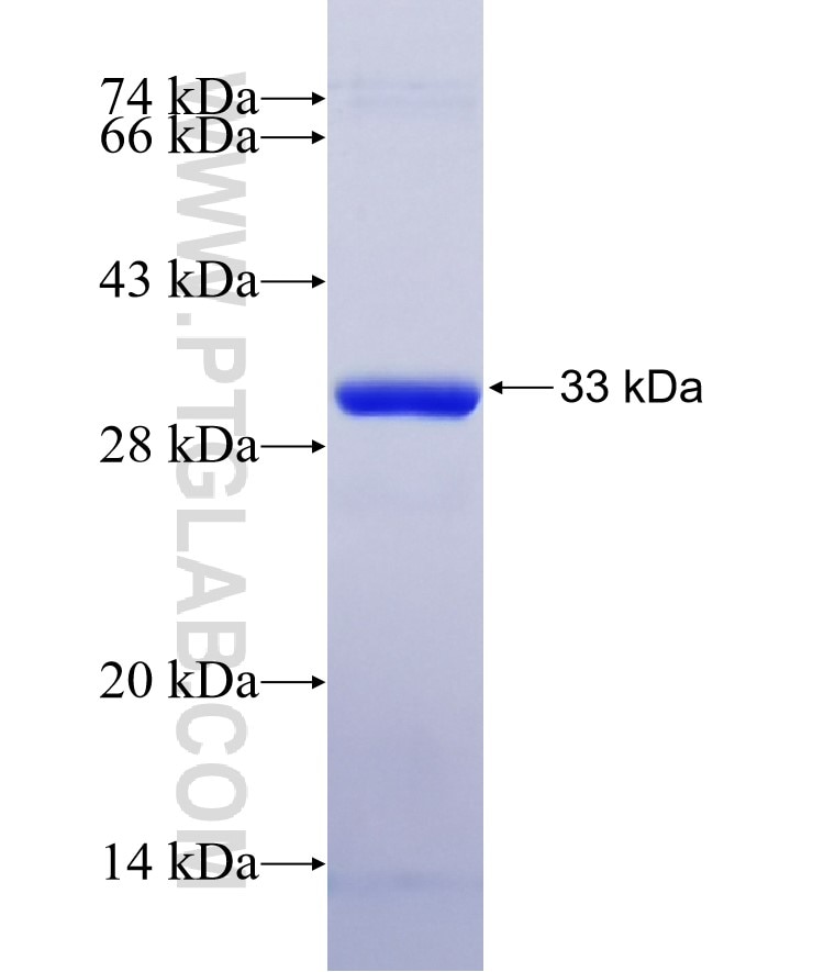TERF2 fusion protein Ag28513 SDS-PAGE