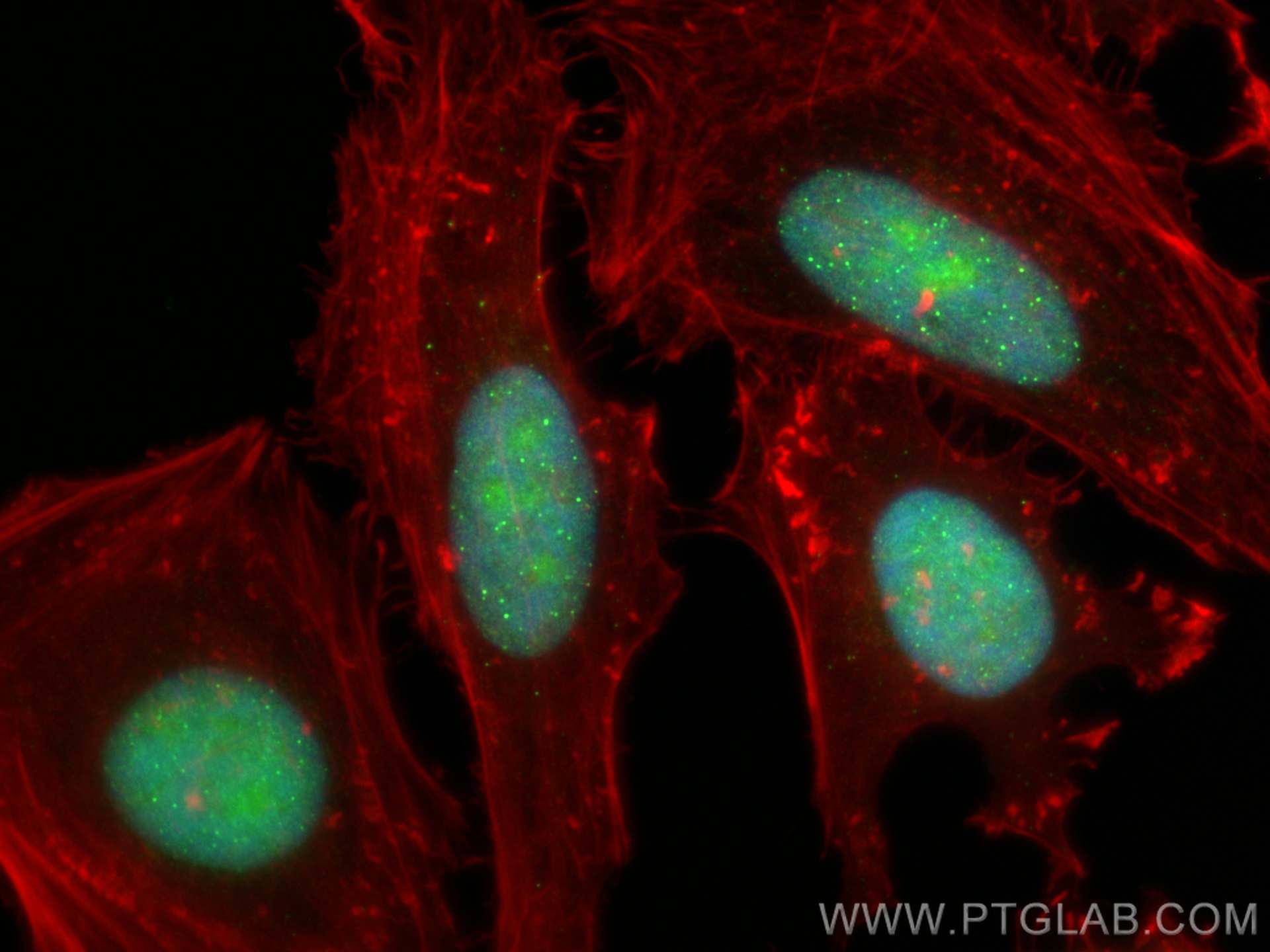 Immunofluorescence (IF) / fluorescent staining of HeLa cells using TERF2IP Polyclonal antibody (14595-1-AP)
