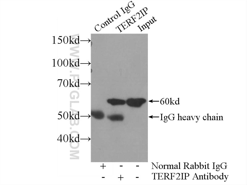 Immunoprecipitation (IP) experiment of HeLa cells using TERF2IP Polyclonal antibody (14595-1-AP)