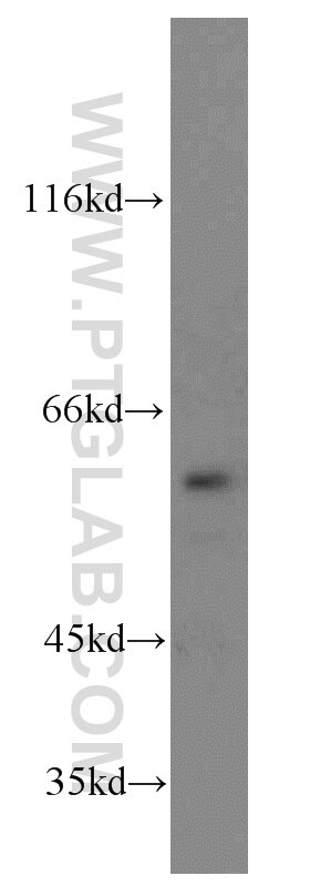 Western Blot (WB) analysis of HeLa cells using TERF2IP Polyclonal antibody (14595-1-AP)