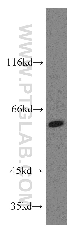 Western Blot (WB) analysis of human placenta tissue using TERF2IP Polyclonal antibody (14595-1-AP)