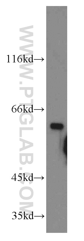 Western Blot (WB) analysis of A431 cells using TERF2IP Polyclonal antibody (14595-1-AP)