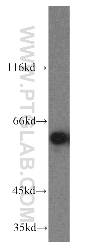 Western Blot (WB) analysis of K-562 cells using TERF2IP Polyclonal antibody (14595-1-AP)