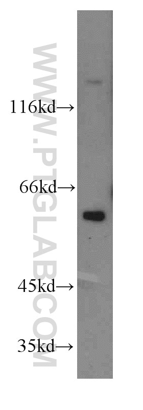 Western Blot (WB) analysis of HeLa cells using TERF2IP Polyclonal antibody (14595-1-AP)