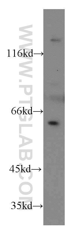 Western Blot (WB) analysis of HT-1080 cells using TERF2IP Polyclonal antibody (14595-1-AP)