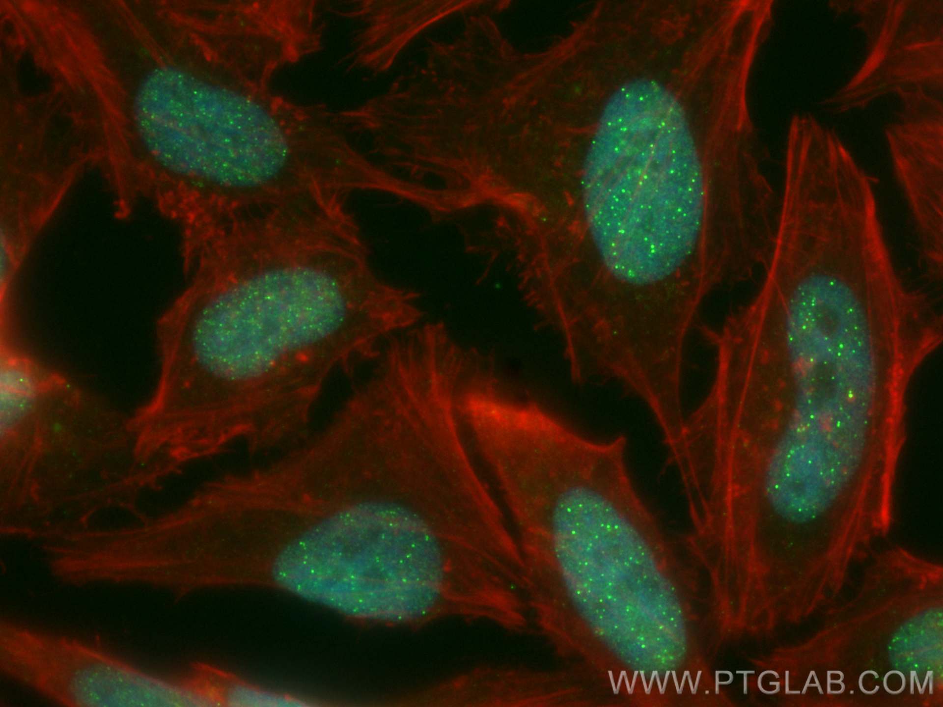 Immunofluorescence (IF) / fluorescent staining of HeLa cells using CoraLite® Plus 488-conjugated TERF2IP Polyclonal a (CL488-14595)