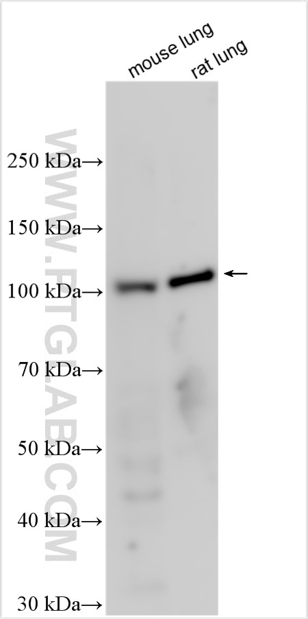 Western Blot (WB) analysis of various lysates using TERT Polyclonal antibody (27586-1-AP)