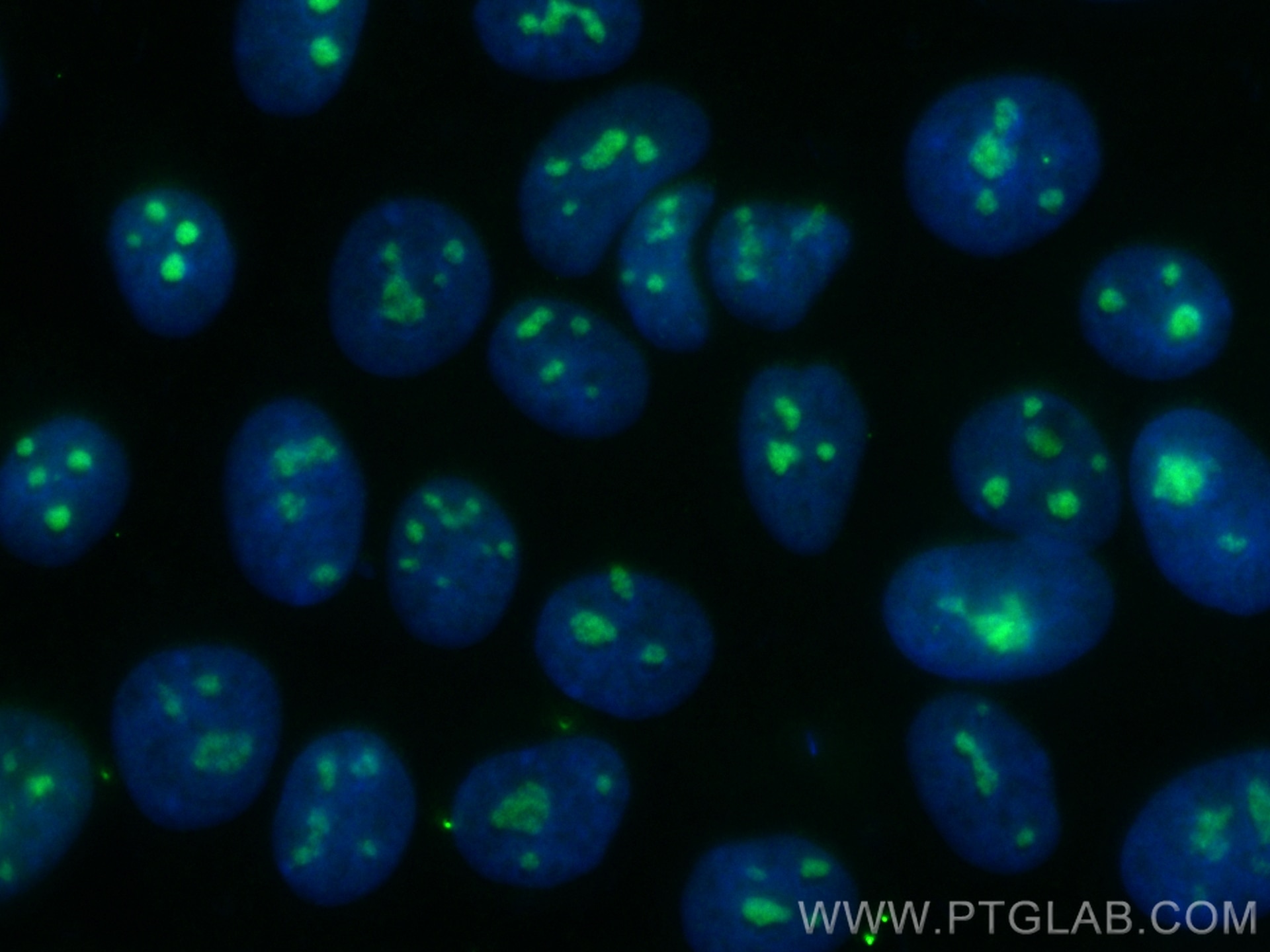 Immunofluorescence (IF) / fluorescent staining of MCF-7 cells using CoraLite® Plus 488-conjugated TERT Recombinant ant (CL488-84636)