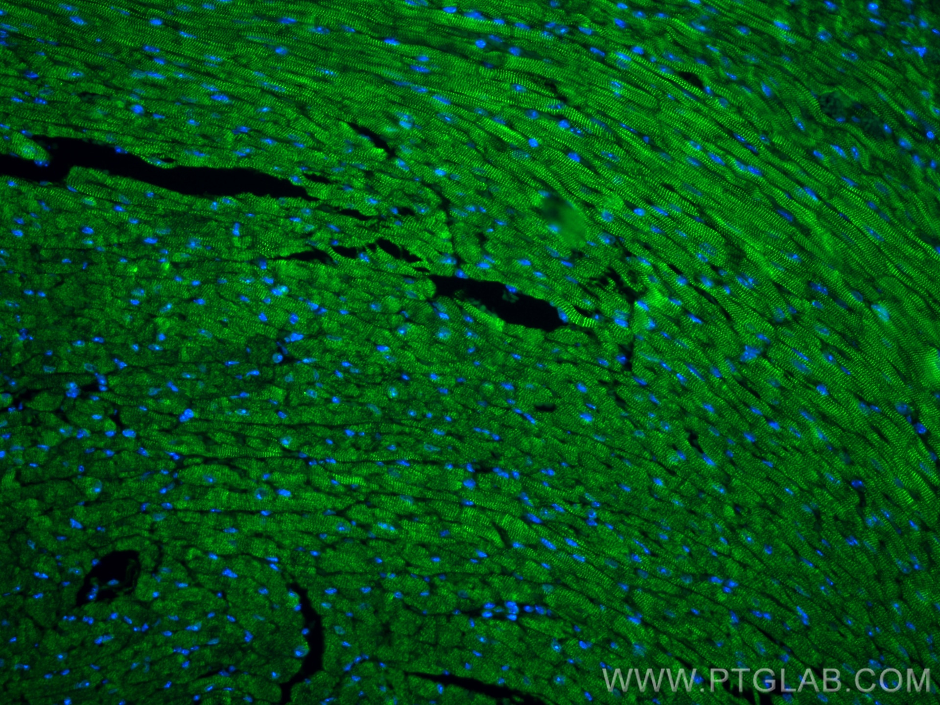 Immunofluorescence (IF) / fluorescent staining of mouse heart tissue using Testin Polyclonal antibody (10258-1-AP)