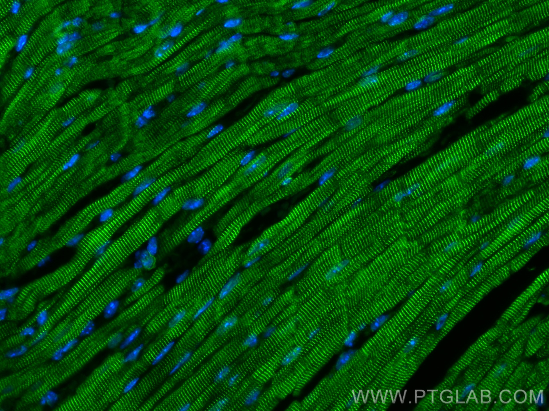 Immunofluorescence (IF) / fluorescent staining of mouse heart tissue using Testin Polyclonal antibody (10258-1-AP)