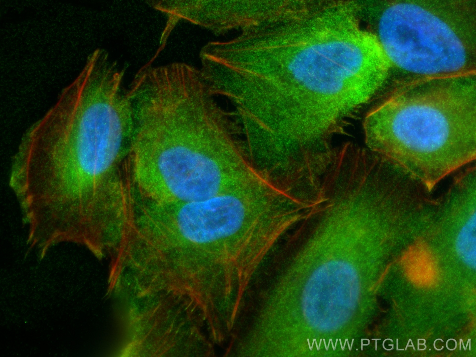 Immunofluorescence (IF) / fluorescent staining of A549 cells using Testin Polyclonal antibody (10258-1-AP)