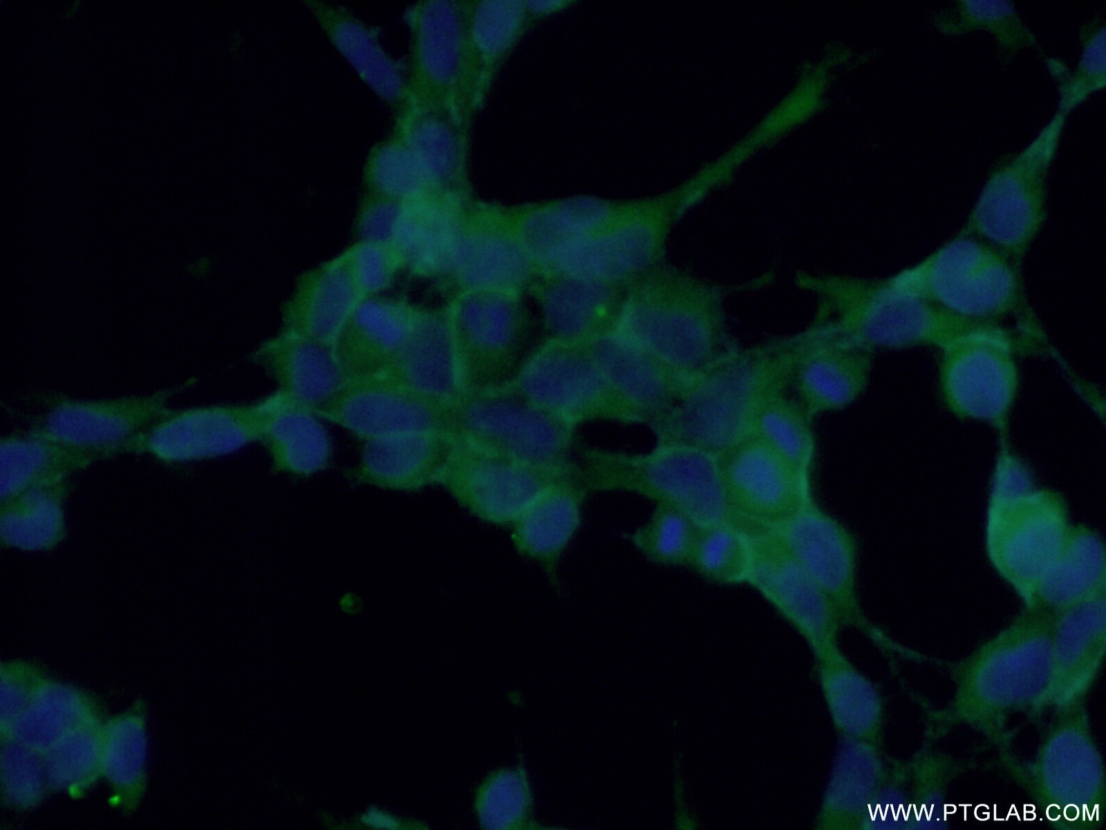 Immunofluorescence (IF) / fluorescent staining of HEK-293 cells using TES Polyclonal antibody (10258-1-AP)