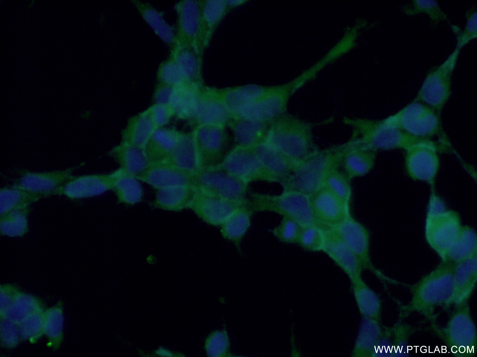 Immunofluorescence (IF) / fluorescent staining of HEK-293 cells using Testin Polyclonal antibody (10258-1-AP)