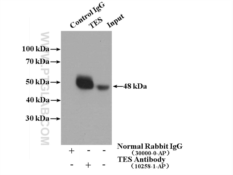 Immunoprecipitation (IP) experiment of K-562 cells using TES Polyclonal antibody (10258-1-AP)