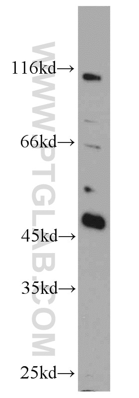 Western Blot (WB) analysis of MCF-7 cells using TES Polyclonal antibody (10258-1-AP)