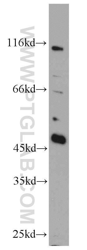 WB analysis of MCF-7 using 10258-1-AP