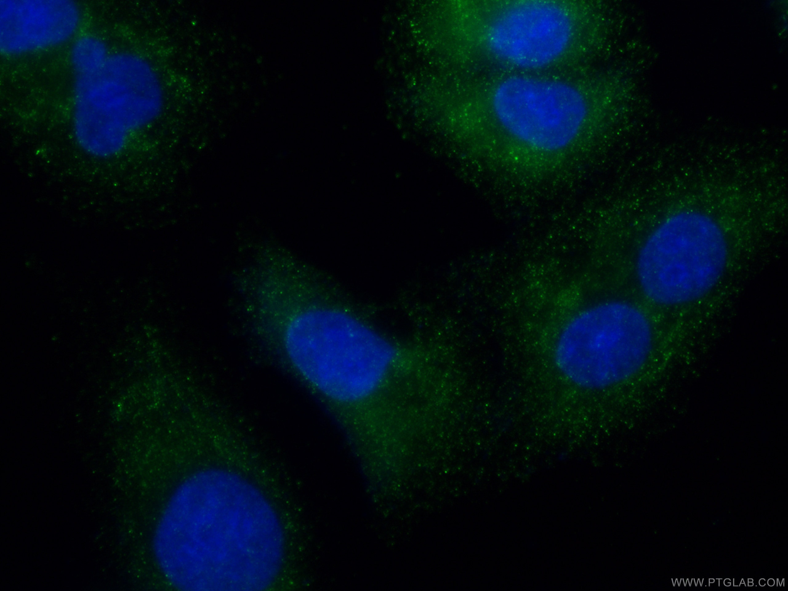 Immunofluorescence (IF) / fluorescent staining of A549 cells using TESC Polyclonal antibody (11125-1-AP)