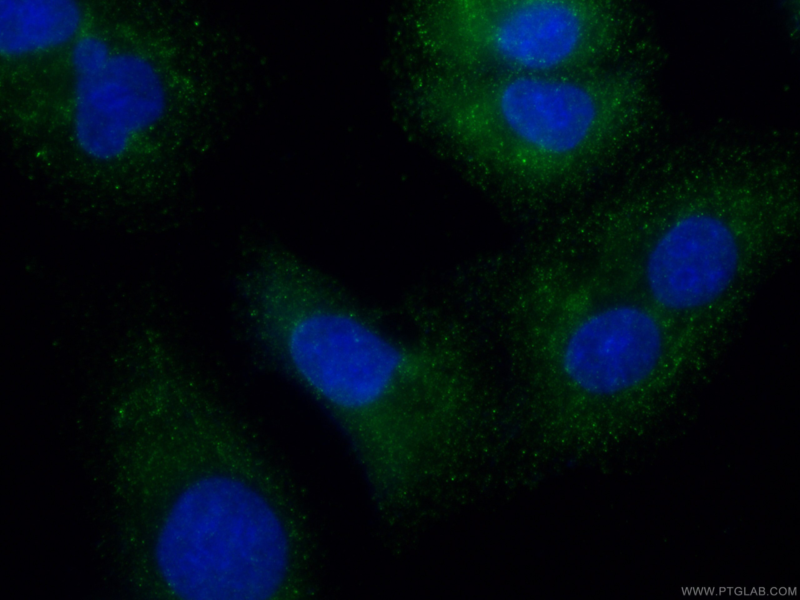 IF Staining of A549 using 11125-1-AP