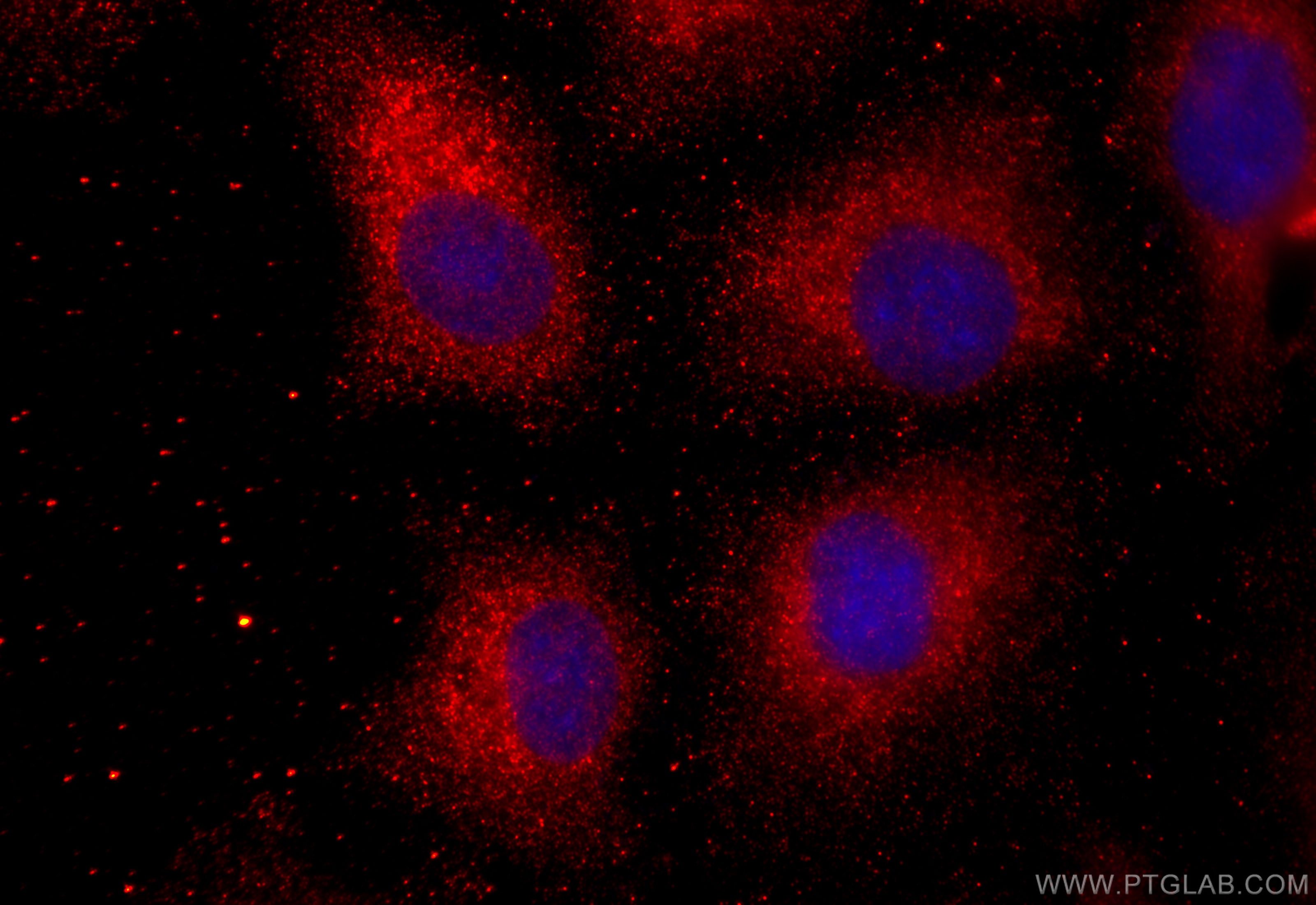 Immunofluorescence (IF) / fluorescent staining of A549 cells using TESC Polyclonal antibody (11125-1-AP)