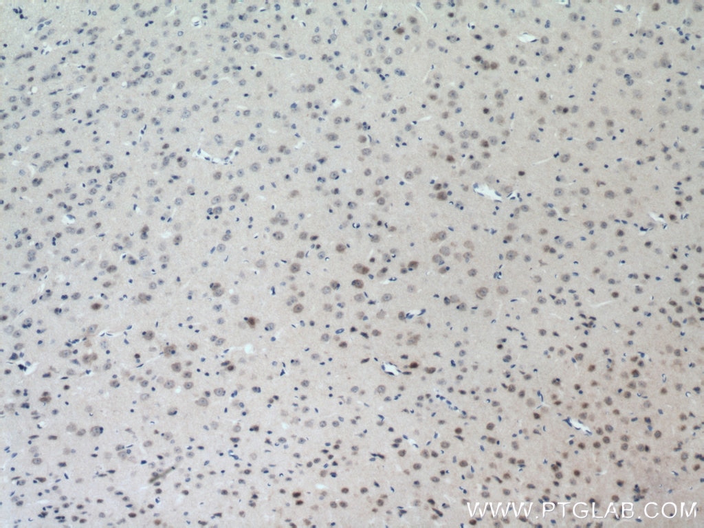 IHC staining of mouse brain using 11125-1-AP
